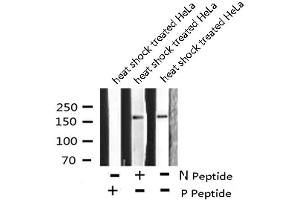 Image no. 4 for anti-Eukaryotic Translation Initiation Factor 2 alpha Kinase 4 (EIF2AK4) (pThr899) antibody (ABIN6271474)