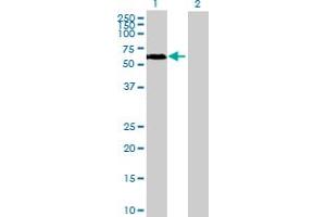 Western Blot analysis of BTBD10 expression in transfected 293T cell line by BTBD10 MaxPab polyclonal antibody.