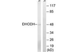 Image no. 1 for anti-Dihydroorotate Dehydrogenase (DHODH) (AA 211-260) antibody (ABIN1534831)