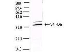 SARS-CoV-2 NSP5 (3CL-Pro) antibody