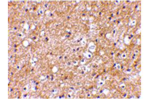 Image no. 3 for anti-SP110 Nuclear Body Protein (SP110) (C-Term) antibody (ABIN6656375)