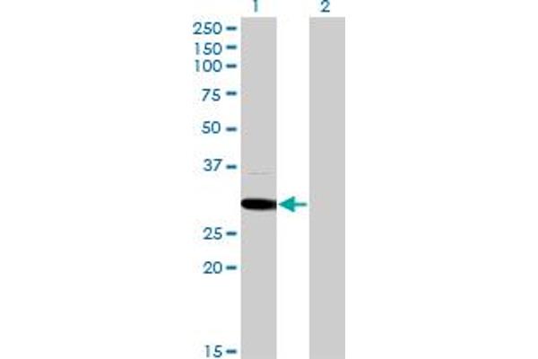 anti-Mediator Complex Subunit 6 (MED6) (AA 1-246) antibody
