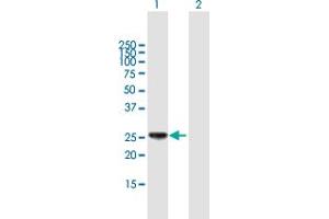 Image no. 1 for anti-Major Histocompatibility Complex, Class II, DP beta 1 (HLA-DPB1) (AA 1-258) antibody (ABIN516496)