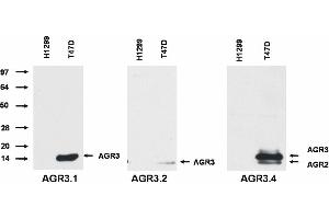 Image no. 2 for anti-Anterior Gradient 3 (AGR3) antibody (ABIN343711)