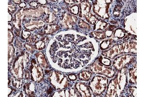 Image no. 2 for anti-Neuroblastoma 1, DAN Family BMP Antagonist (NBL1) (AA 1-180) antibody (ABIN1995907)