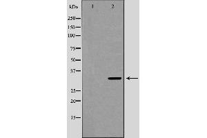 Image no. 2 for anti-Uncoupling Protein 3 (Mitochondrial, Proton Carrier) (UCP3) (C-Term) antibody (ABIN6265870)