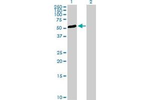 Image no. 1 for anti-Transforming Growth Factor beta 1 Induced Transcript 1 (TGFB1I1) (AA 1-444) antibody (ABIN520872)