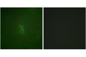 Image no. 2 for anti-BCL2-Like 1 (BCL2L1) (AA 13-62), (pThr47) antibody (ABIN1531492)
