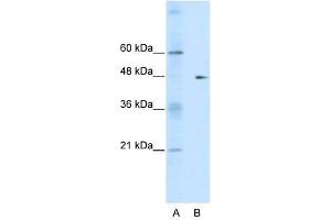 Image no. 1 for anti-GDP Dissociation Inhibitor 2 (GDI2) (C-Term) antibody (ABIN926973)