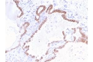 Image no. 4 for anti-Keratin 18 (KRT18) antibody (ABIN6939938)