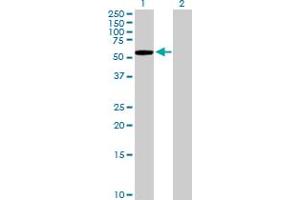 Image no. 1 for anti-Kelch-Like 7 (KLHL7) (AA 1-586) antibody (ABIN527829)