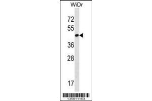 Image no. 1 for anti-THAP Domain Containing 11 (THAP11) (N-Term) antibody (ABIN2504772)