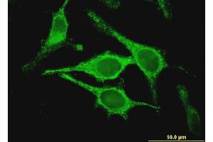 Image no. 3 for anti-Chloride Intracellular Channel 5 (CLIC5) (AA 91-190) antibody (ABIN526971)