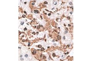 Image no. 2 for anti-Kv Channel Interacting Protein 3, Calsenilin (KCNIP3) (AA 1-30), (N-Term) antibody (ABIN357125)