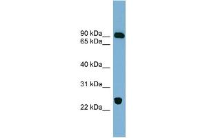 Image no. 1 for anti-Vacuolar Protein Sorting 53 Homolog (VPS53) (Middle Region) antibody (ABIN2787108)