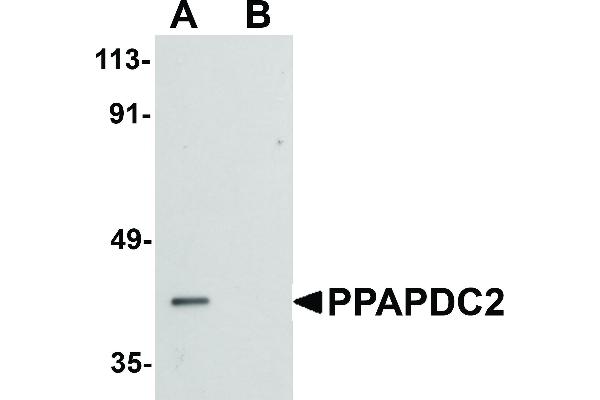 PPAPDC2 Antikörper  (C-Term)