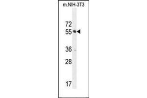 Image no. 3 for anti-CTD (Carboxy-Terminal Domain, RNA Polymerase II, Polypeptide A) Small Phosphatase Like 2 (CTDSPL2) (AA 55-84), (N-Term) antibody (ABIN951727)