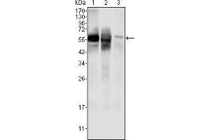 Image no. 2 for anti-Glucose-6-Phosphate Isomerase (GPI) antibody (ABIN969176)