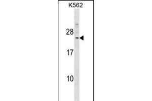 DCAKD antibody  (N-Term)