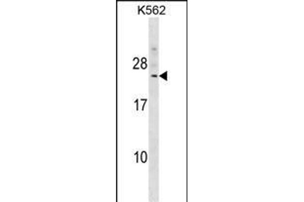 DCAKD antibody  (N-Term)