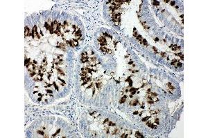 Image no. 1 for anti-Retinoblastoma-Like 1 (p107) (RBL1) (C-Term) antibody (ABIN3032468)