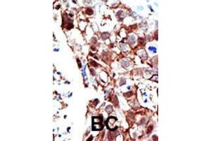 Image no. 2 for anti-Protein Inhibitor of Activated STAT, 2 (PIAS2) (AA 1-30), (C-Term) antibody (ABIN1882114)