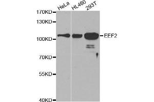Image no. 1 for anti-Eukaryotic Translation Elongation Factor 2 (EEF2) antibody (ABIN3022843)