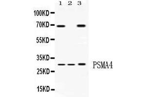 Image no. 1 for anti-Proteasome Subunit alpha 4 (PSMA4) (AA 84-123), (Middle Region) antibody (ABIN4886707)