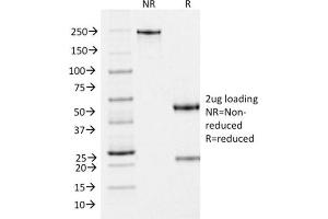 Image no. 1 for anti-Premelanosome Protein (PMEL) (AA 376-502) antibody (ABIN6940589)