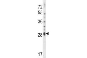 Image no. 2 for anti-Interleukin 17D (IL17D) (AA 155-183) antibody (ABIN3028757)