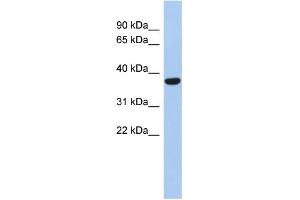 Image no. 1 for anti-Phosphatidic Acid Phosphatase Type 2 Domain Containing 2 (PPAPDC2) (N-Term) antibody (ABIN2774128)
