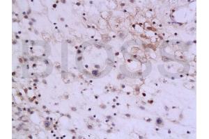 Image no. 1 for anti-Interleukin 13 (IL13) (AA 45-56) antibody (ABIN670116)