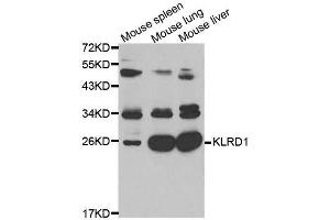 Image no. 5 for anti-Killer Cell Lectin-Like Receptor Subfamily D, Member 1 (KLRD1) antibody (ABIN3022763)