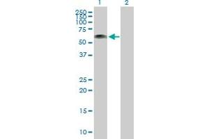 Image no. 1 for anti-Kazrin (KAZ) (AA 1-415) antibody (ABIN525054)