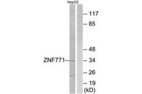 anti-Zinc Finger Protein 771 (ZNF771) (AA 161-210) antibody