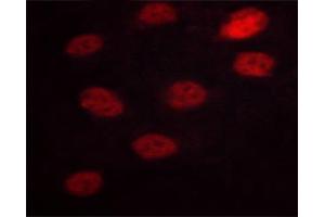 Image no. 2 for anti-Nuclear Factor of Activated T-Cells, Cytoplasmic, Calcineurin-Dependent 3 (NFATC3) (pSer165) antibody (ABIN6256165)