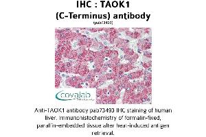 Image no. 2 for anti-TAO Kinase 1 (TAOK1) (C-Term) antibody (ABIN1739898)