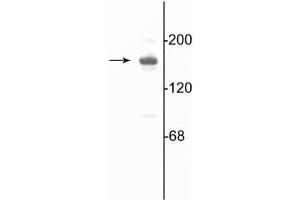 Image no. 2 for anti-Glutamate Receptor, Ionotropic, N-Methyl D-Aspartate 2a (GRIN2A) (C-Term) antibody (ABIN361396)