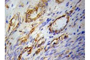Image no. 2 for anti-Peroxisome Proliferator-Activated Receptor gamma (PPARG) (N-Term) antibody (ABIN3020844)