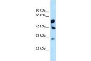Image no. 1 for anti-Lysophosphatidylglycerol Acyltransferase 1 (LPGAT1) (AA 230-279) antibody (ABIN6747957)
