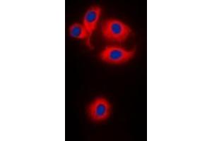 Image no. 1 for anti-Mitochondrial Ribosomal Protein S22 (MRPS22) (Center) antibody (ABIN3071035)