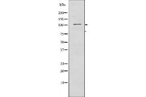 Image no. 2 for anti-Zinc Finger CCCH-Type Containing 7B (ZC3H7B) (C-Term) antibody (ABIN6258361)