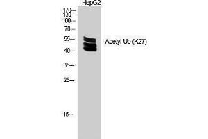 Image no. 1 for anti-Ubiquitin (Ubiquitin) (acLys27) antibody (ABIN3181496)