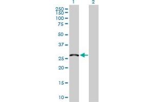 anti-Mediator Complex Subunit 6 (MED6) (AA 1-246) antibody
