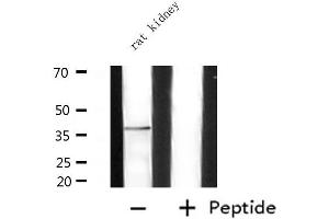 Image no. 3 for anti-Adenosine A2a Receptor (ADORA2A) (Internal Region) antibody (ABIN6256930)