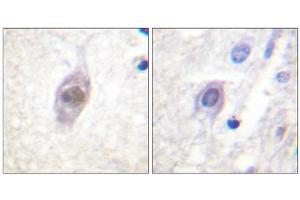 Image no. 2 for anti-Adenomatous Polyposis Coli (APC) (Internal Region) antibody (ABIN1848000)