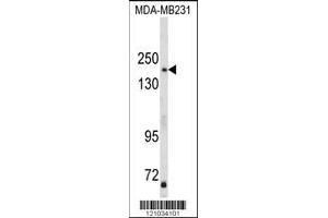 Image no. 1 for anti-TBC1 Domain Family, Member 4 (TBC1D4) (AA 172-201), (N-Term) antibody (ABIN652462)
