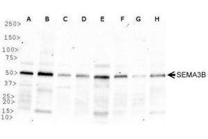 Image no. 2 for anti-Sema Domain, Immunoglobulin Domain (Ig), Short Basic Domain, Secreted, (Semaphorin) 3B (SEMA3B) (AA 100-200) antibody (ABIN1951824)