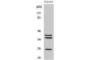 Image no. 1 for anti-Cathepsin B (CTSB) (Internal Region) antibody (ABIN3183690)
