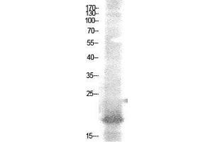 Image no. 2 for anti-Transcription Factor NF-E4 (NFE4) (acLys43) antibody (ABIN3188029)